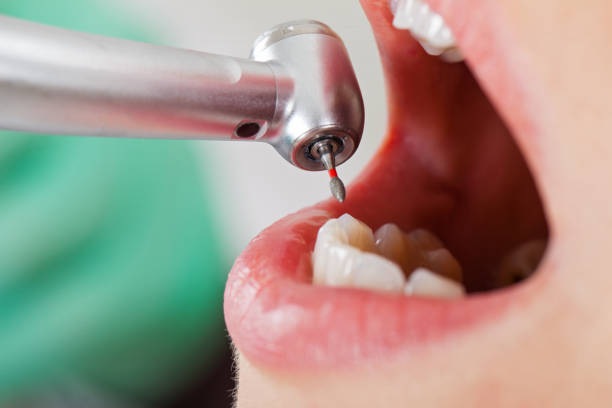 Best Broken Tooth Emergency  in Stonebridge, NJ